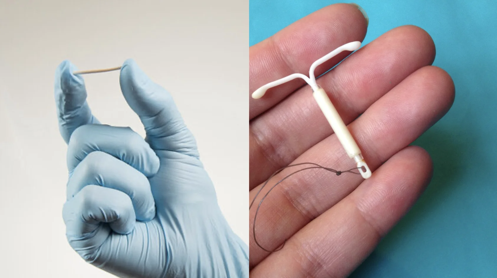 diu; implanon, contraceptivos; contracepção