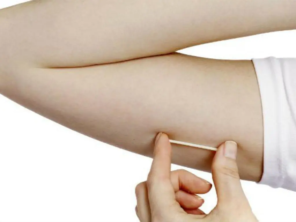 implante hormonal